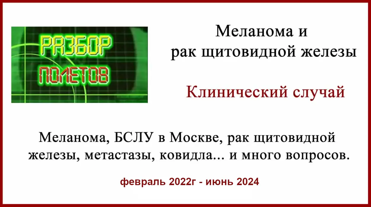 Меланома и рак щитовидной железы, БСЛУ, метастазы. Меланома, БСЛУ в Москве, рак щитовидной железы и смена препаратов