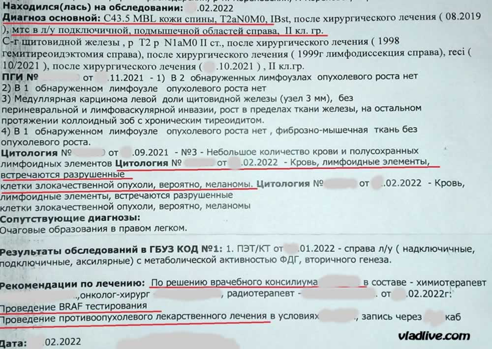 Меланома История болезни