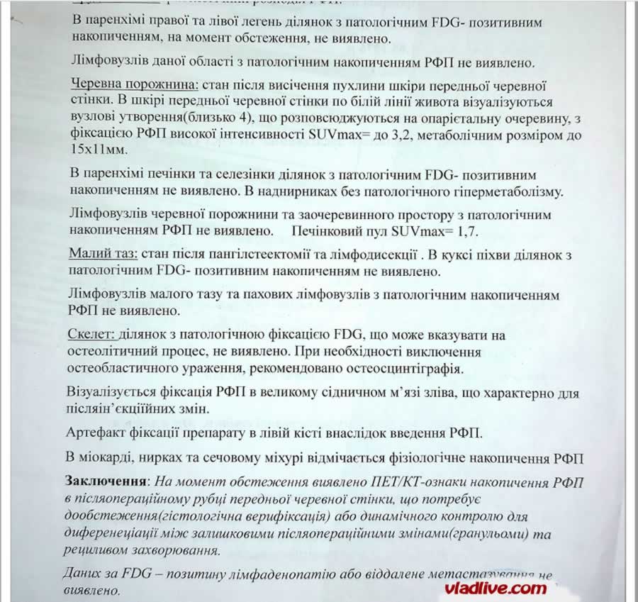 ПЭТ КТ накопление РФП в рубце
