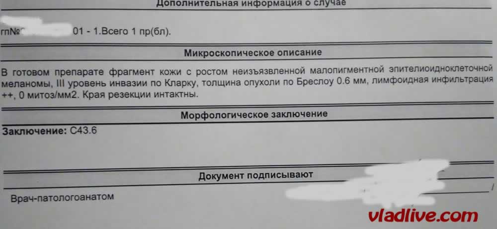 Гистология тонкой меланомы