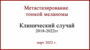 Метастазирование тонкой меланомы