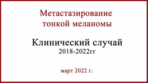 Метастазирование тонкой меланомы