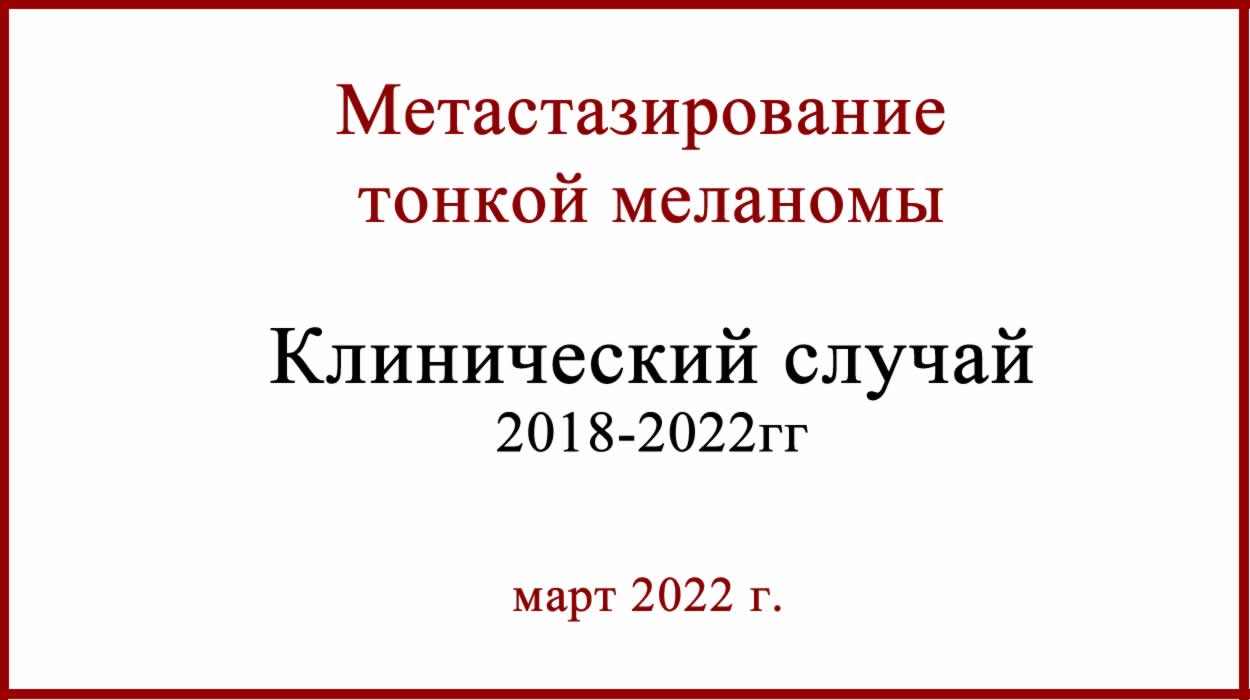 Метастазирование тонкой меланомы