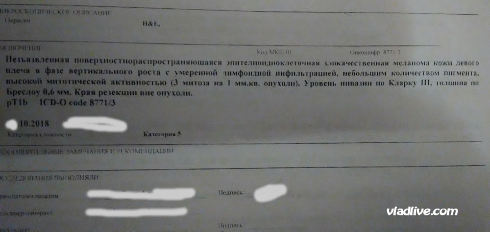Тонкая меланома. 0,6 мм , 3 митоза