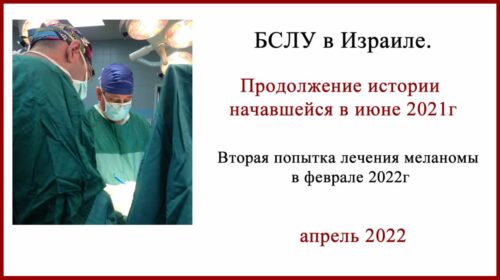 БСЛУ в Израиле 2022