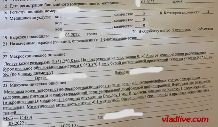 Меланома 1 мм по Бреслоу. Гистология