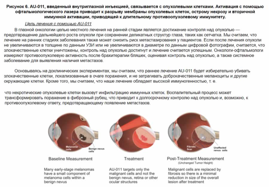Цель лечения AU-011