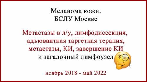 БСЛУ в Москве. Ошибка, метастазы и лечение