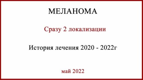 Две меланомы одновременно. История лечения