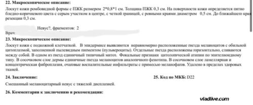 Диспластический невус