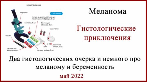 Меланома беременность и гистология