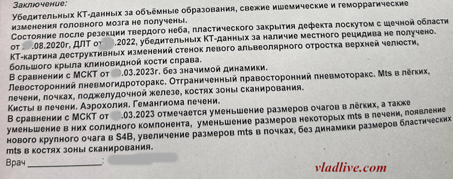 Меланома слизистой. КТ 2023