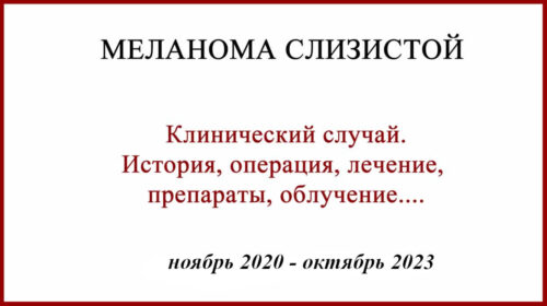 Меланома слизистой твердого неба. Клинический случай