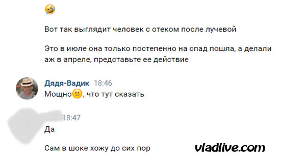 Меланома слизистой. Лучевая терапия