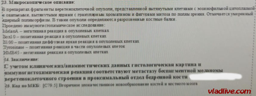 Метастаз меланомы в кость. ИГХ