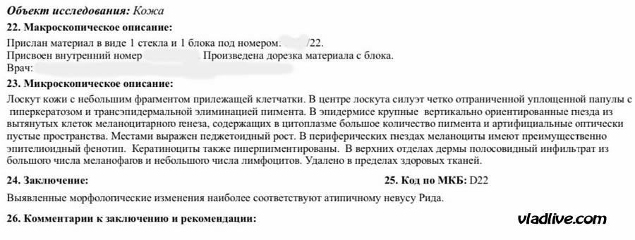 Невус Рида, гистология