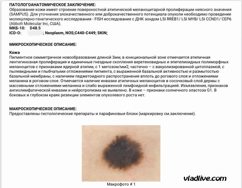 Сампус (sampus) , гистология