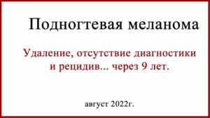 Рецидив подногтевой меланомы через 9 лет после удаления. История