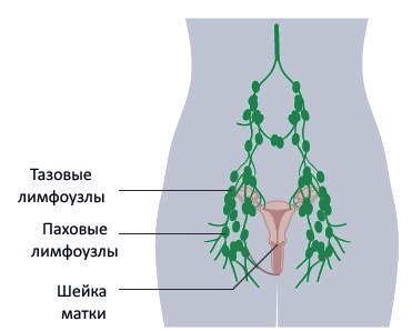 Конгломерат лимфоузлов