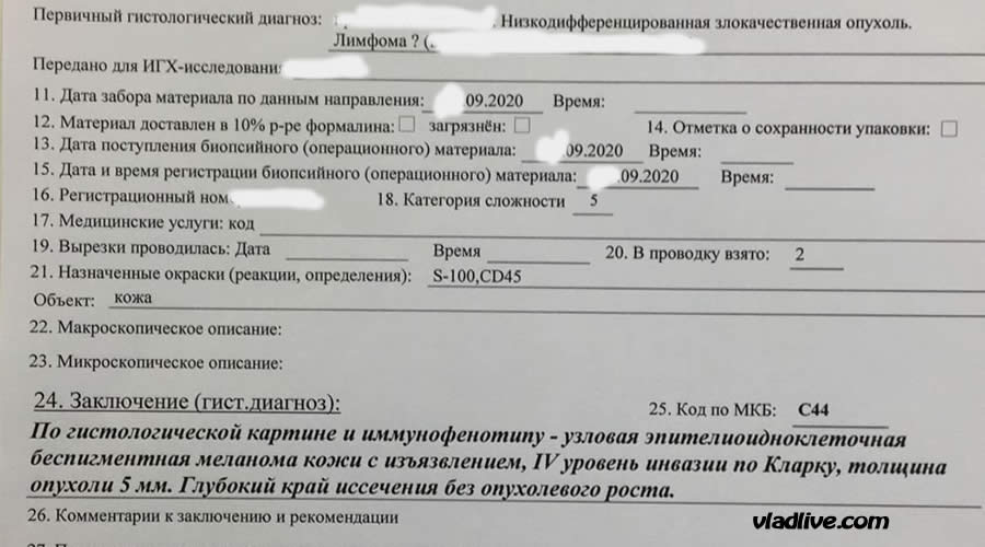 Меланома. Ошибка гистологии