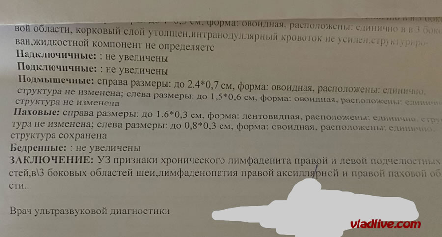 Меланома. УЗИ вместо Биопсии сторожевых лимфоузлов