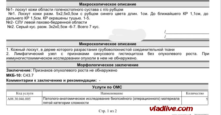 Лимфоузел БСЛУ