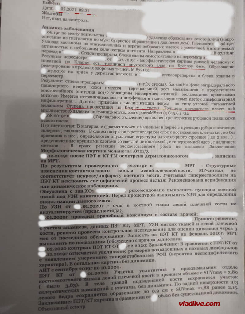 Меланома 6 мм история болезни