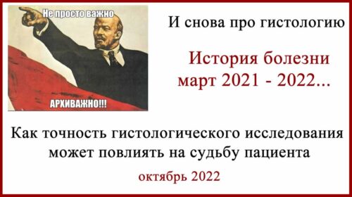 Про гистологию меланомы. Зачем нужна ревизия гистологии