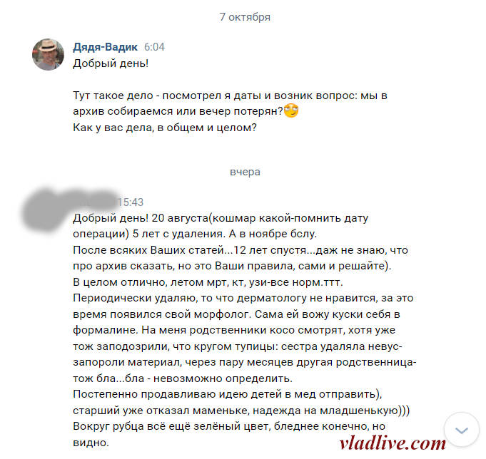 Лечение меланомы. БСЛУ в Израиле. Прошло 5 лет.