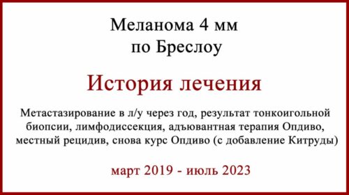 Меланома 4 мм по Бреслоу. История лечения