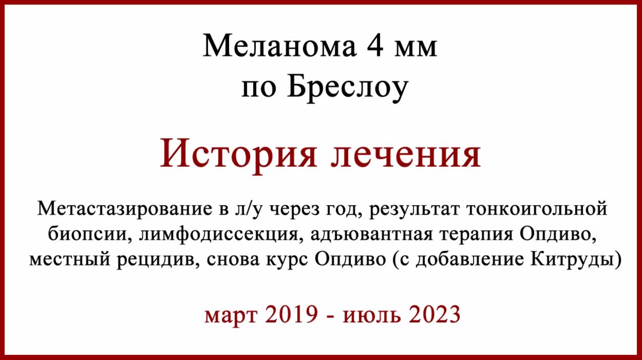 Меланома 4 мм по Бреслоу, Кларку 4, pT4рNОMО. N0? Меланома 4 мм по Бреслоу. История лечения