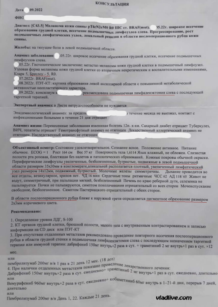 Наблюдение за меланомой. Консультация