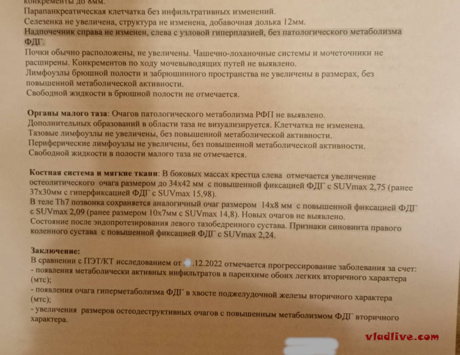 ПЭТ КТ апрель 2023