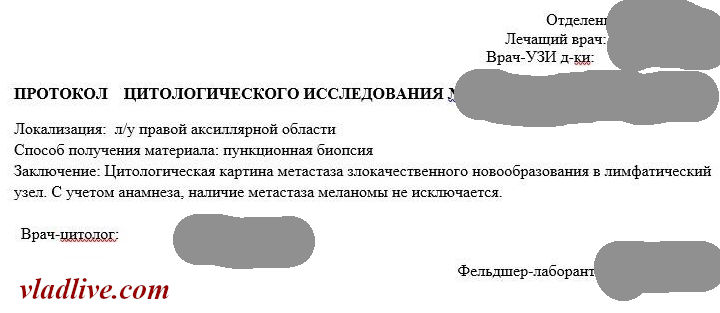 Цитология после биопсии лимфоузла.