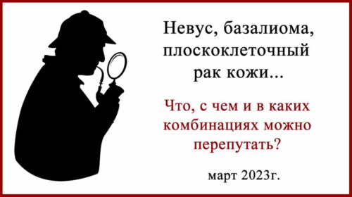 Базалиома, плоскоклеточный рак и меланома кожи