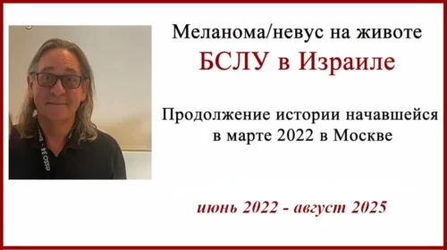 Меланома на животе (у пупка). Выполнение БСЛУ в Израиле. Профессор Хаим Гутман. Фото , документы