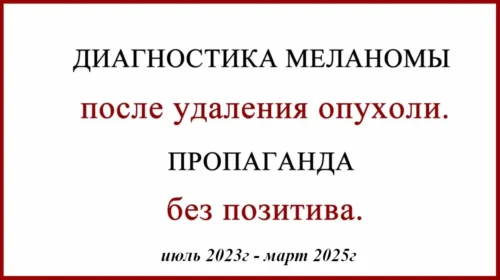 Диагностика после удаления меланомы. Клинический случай. Метастаз меланомы, фото