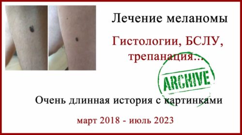 Израиль, БСЛУ, пять лет после операции