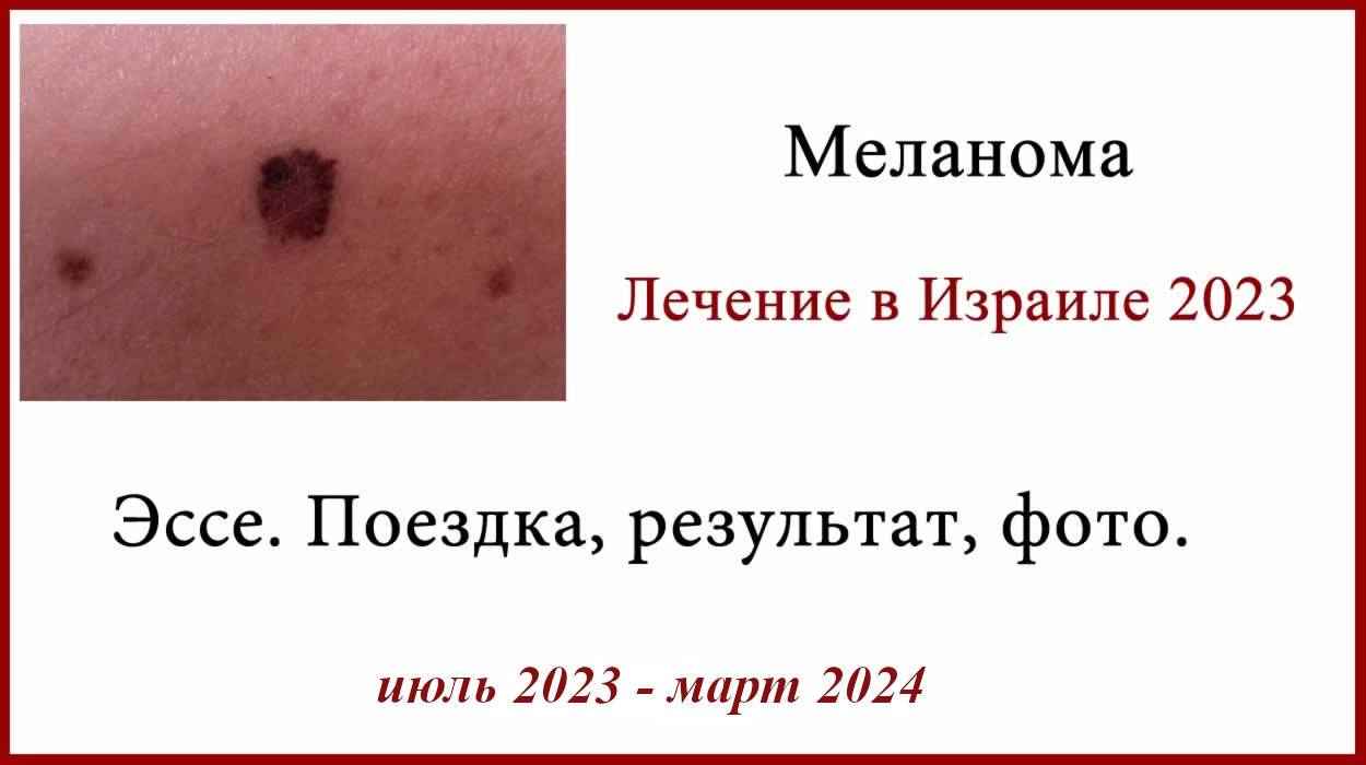 Отзыв о лечении в Израиле в 2023. Поездка, фото, результат и психологические проблемы после лечения