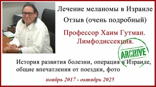 История лечения в Израиле. Меланома. Метастаз. Лимфодиссекция История лечения в Израиле. Лимфодиссекция и адъювантная терапия ниволумабом. 8 лет после операции.