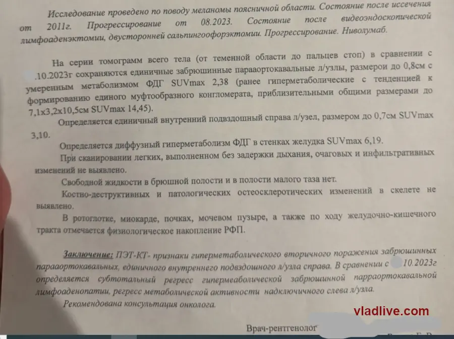 Ниволумаб. Частичный ответ