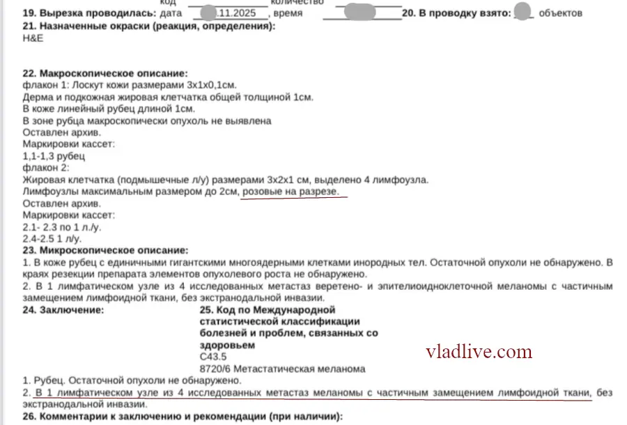 ИГХ