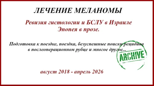 Отзыв о выполнении БСЛУ в Израиле. История лечения меланомы. 8 лет после операции.
