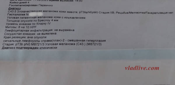 Меланома IIb