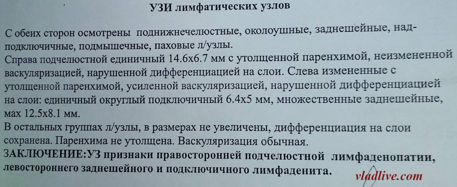 УЗИ лимфоузлов на шее