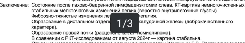 Компьютерная томография