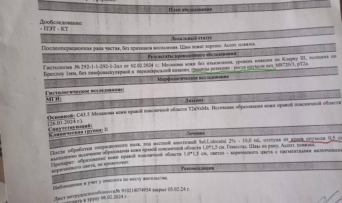 Меланома. Отступы при удалении. Эксцизионная биопсия и широкое иссечение