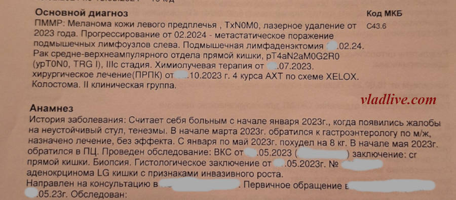 Меланома и лазер. История болезни