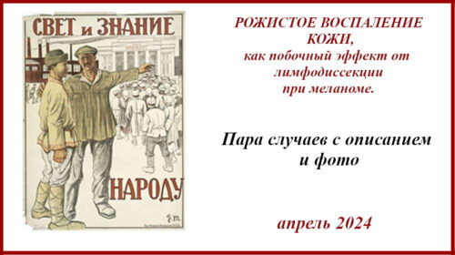 Рожистое воспаление кожи (РОЖА) после лимфодиссекции при меланоме.