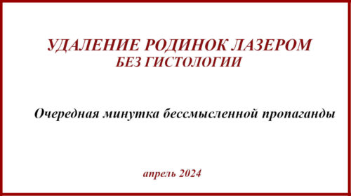 Удаление родинок лазером без гистологии. Примеры и возможные последствия.